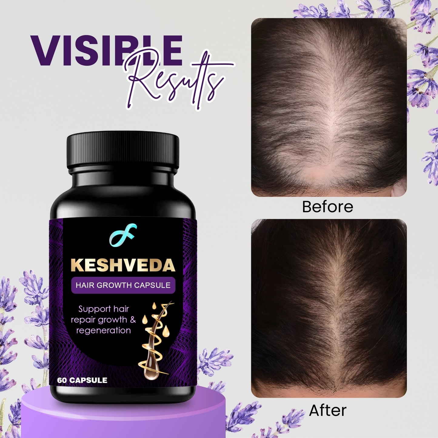 Keshveda Hair Growth Capsule